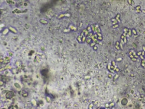 Blick durch ein Mikroskop. Zu erkennen sind Nosema-Sporen, welche sich als kleine, längliche Punkte zeigen.